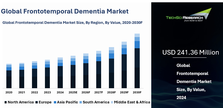 Frontotemporal Dementia Market By Size, Share, Growth and Forecast 2030